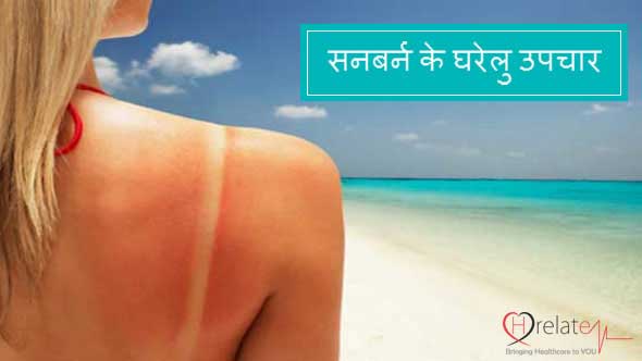 जानिए धूप से झुलसी त्वचा (सनबर्न) को ठीक करने के घरेलु उपचार