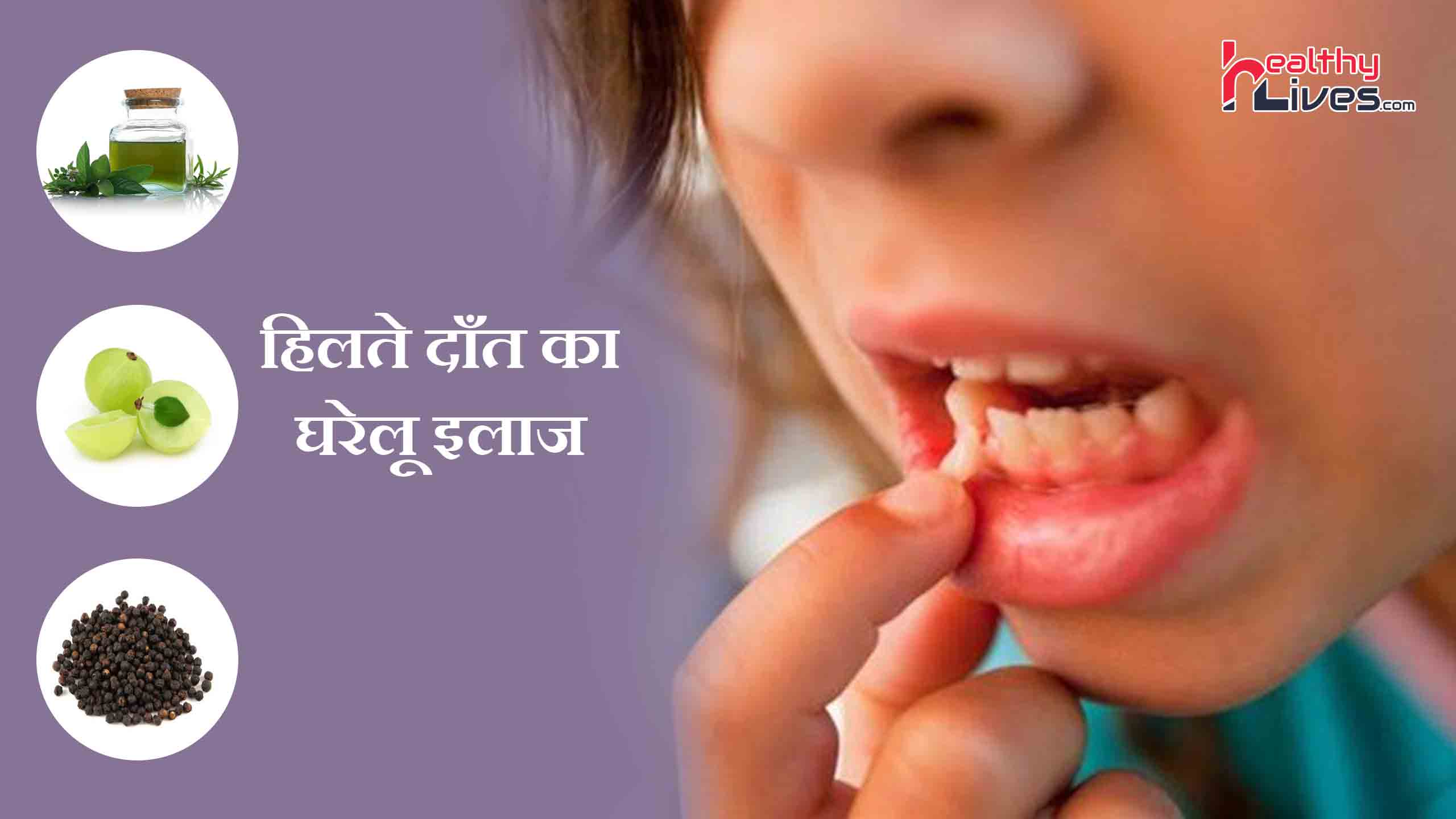 Home Remedies for Loose Teeth: हिलते दांतों को ठीक करने के घरेलू उपचार