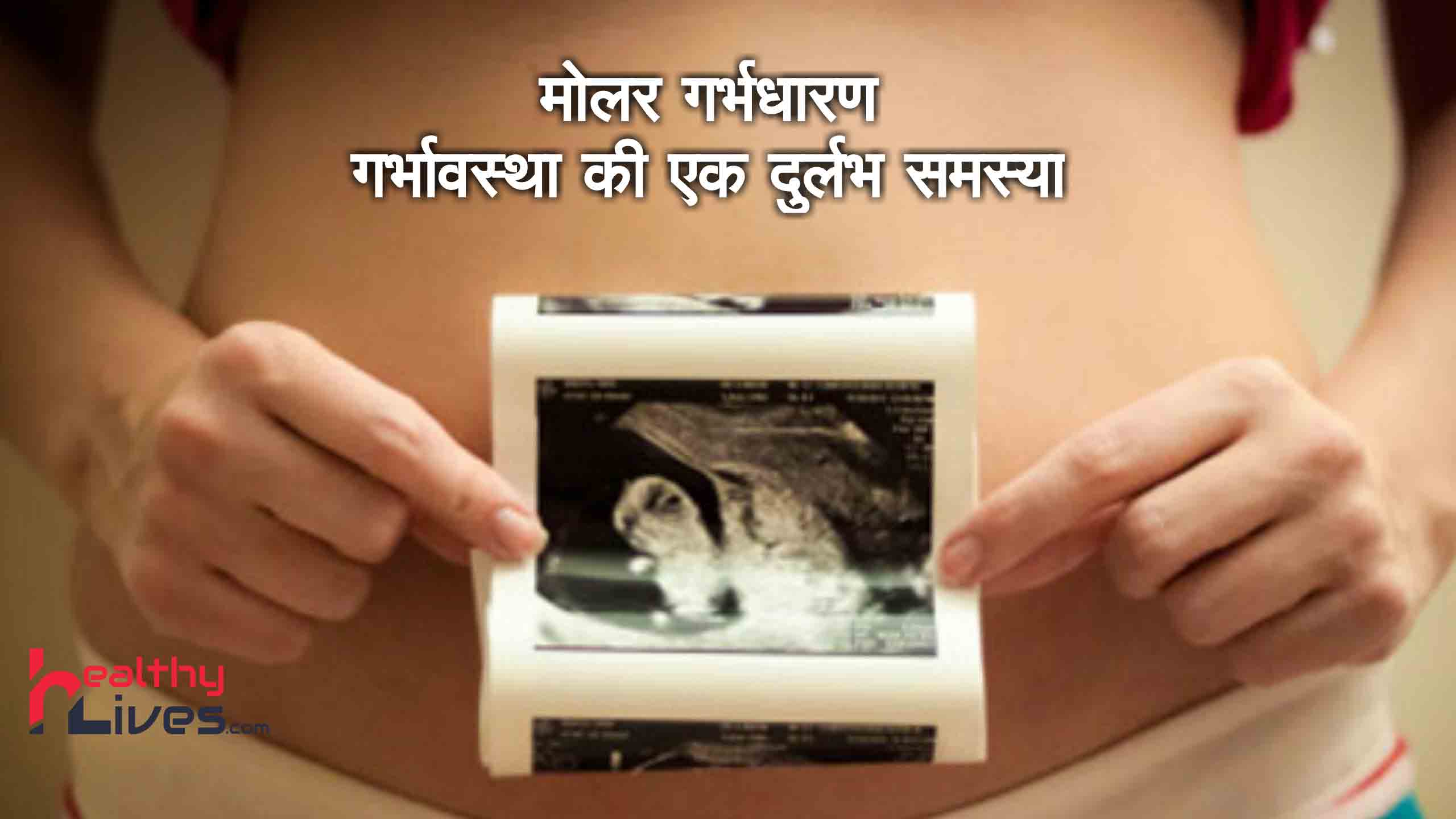 Molar Pregnancy: गर्भावस्था की सबसे संवेदनशील अवस्था, जानिए प्रमुख जानकारी