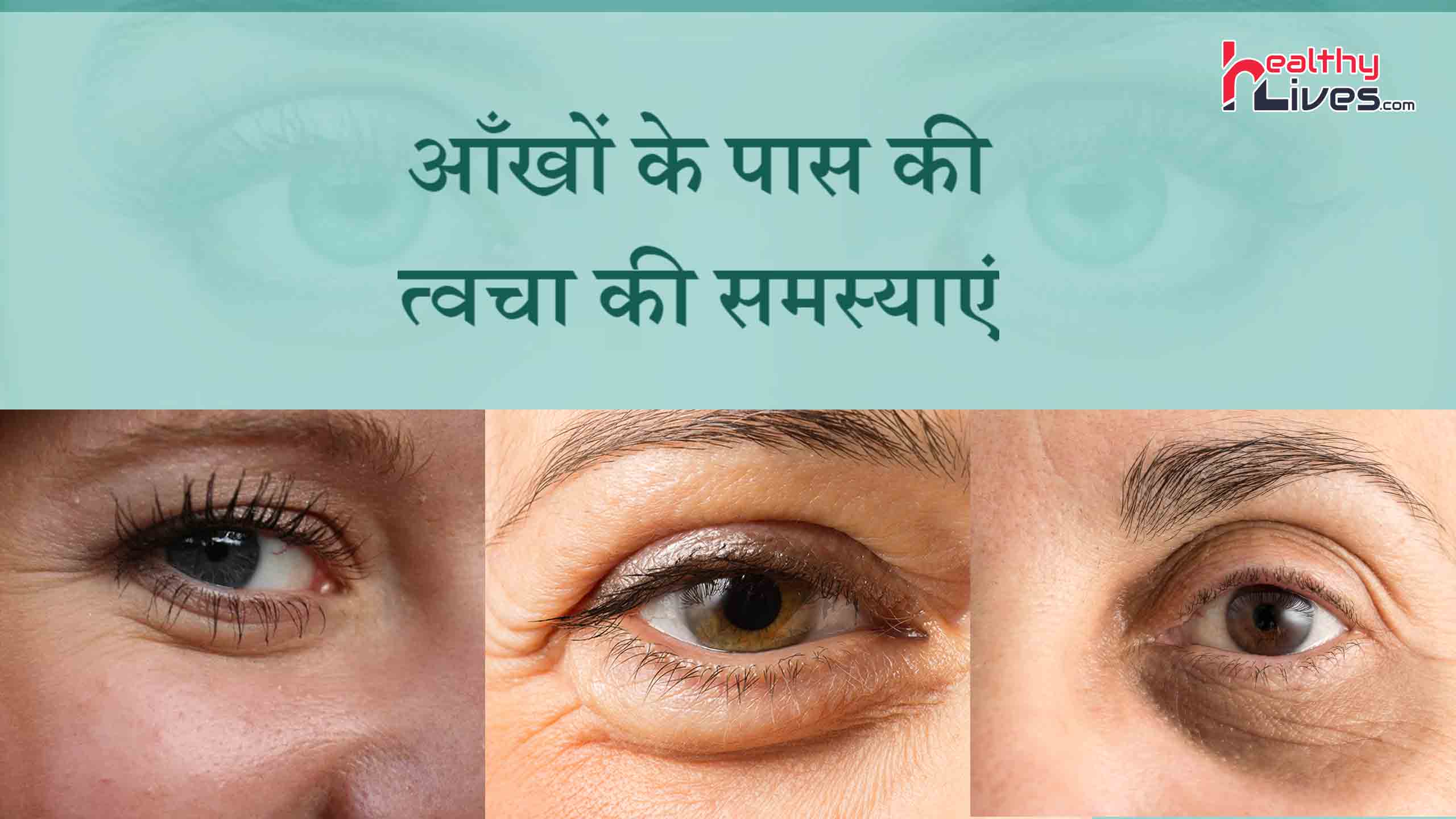 Skin Problems Under the Eyes: जानिए आँखों के नीचे होने वाले समस्याओं के बारे