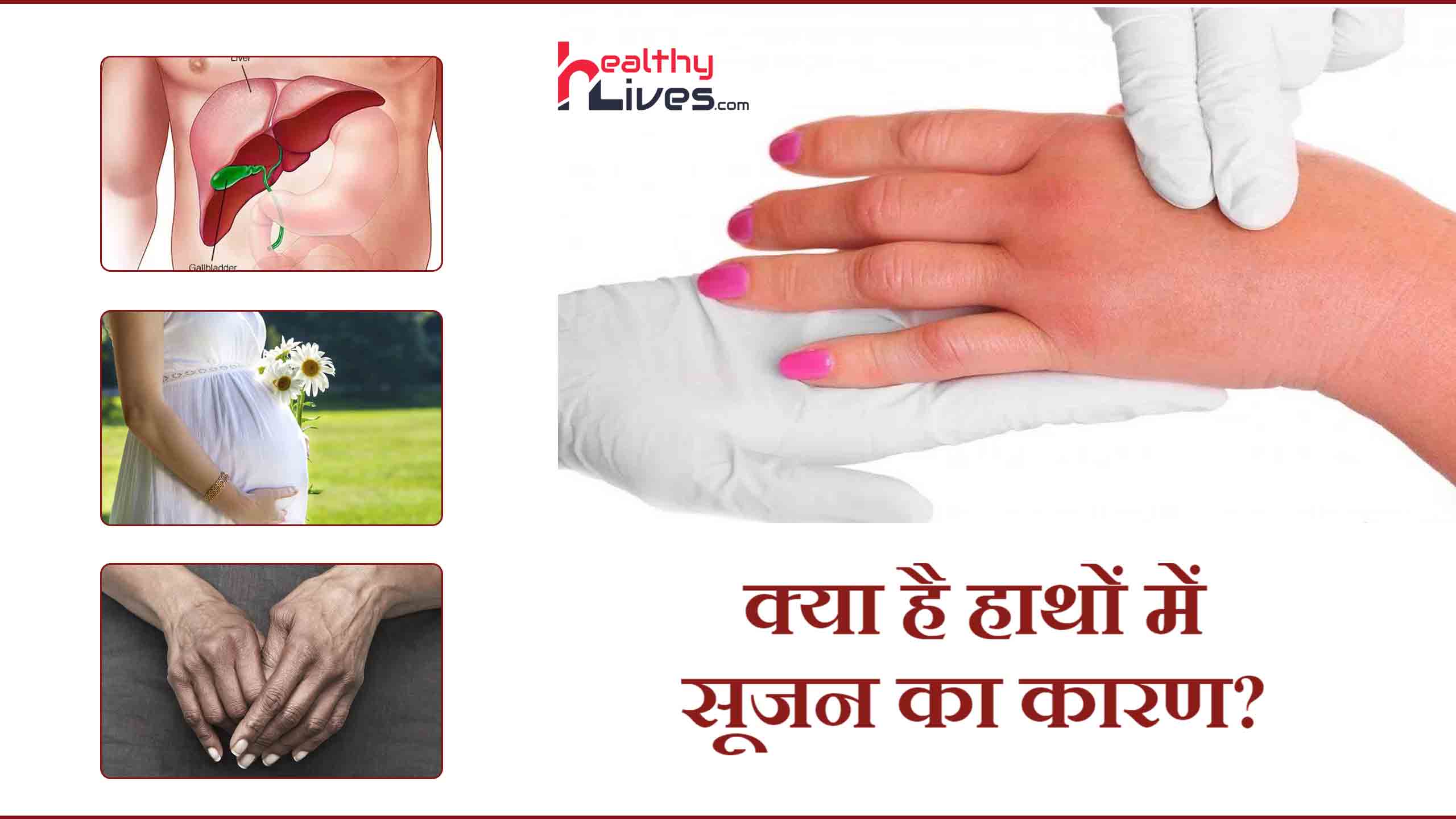 Swollen Hands Causes: जानिए किस कारण आती है हाथों में सूजन?
