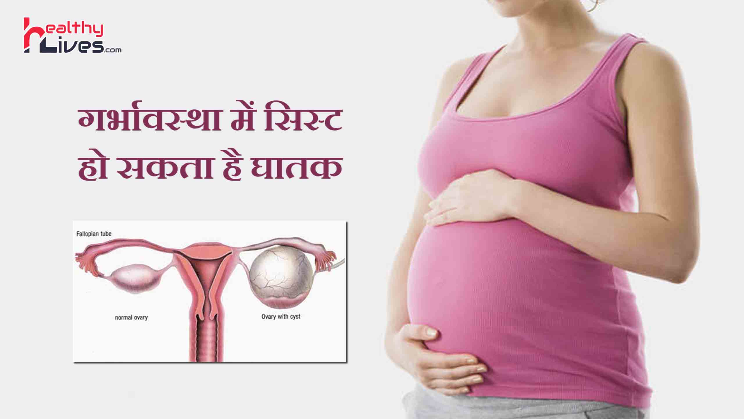 Cyst in Pregnancy: गर्भावस्था के दौरान घातक हो सकती है सिस्ट, जानिए इसके जोखिम