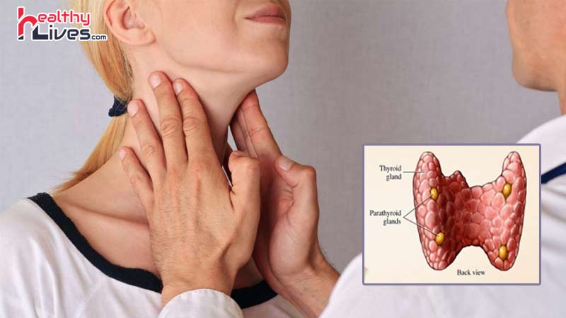 Thyroid-Disorders-Causes