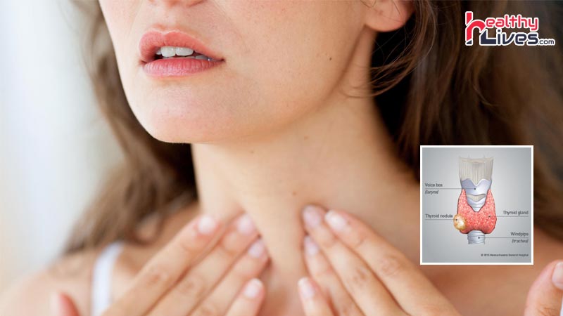 Worst-Foods-for-Your-Thyroid