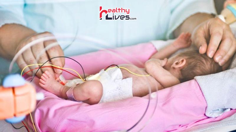 Premature-Baby-Problems-in-Hindi
