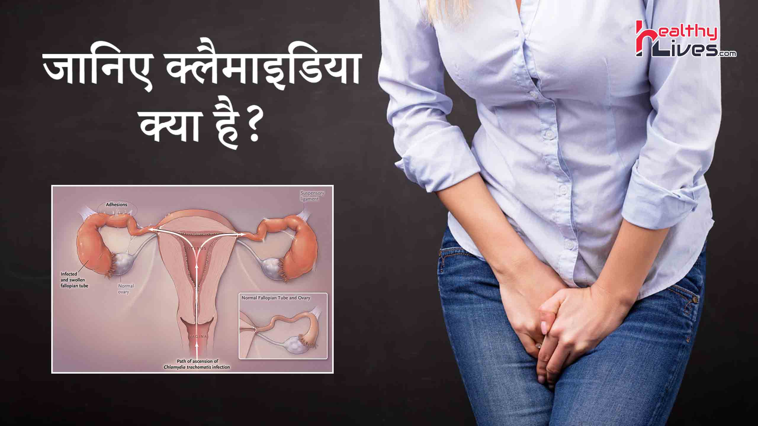 Chlamydia in Hindi: सेक्सुअल ट्रांसमिटेड इंफेक्शन क्लैमाइडिया होने के कारण, लक्षण और बचाव