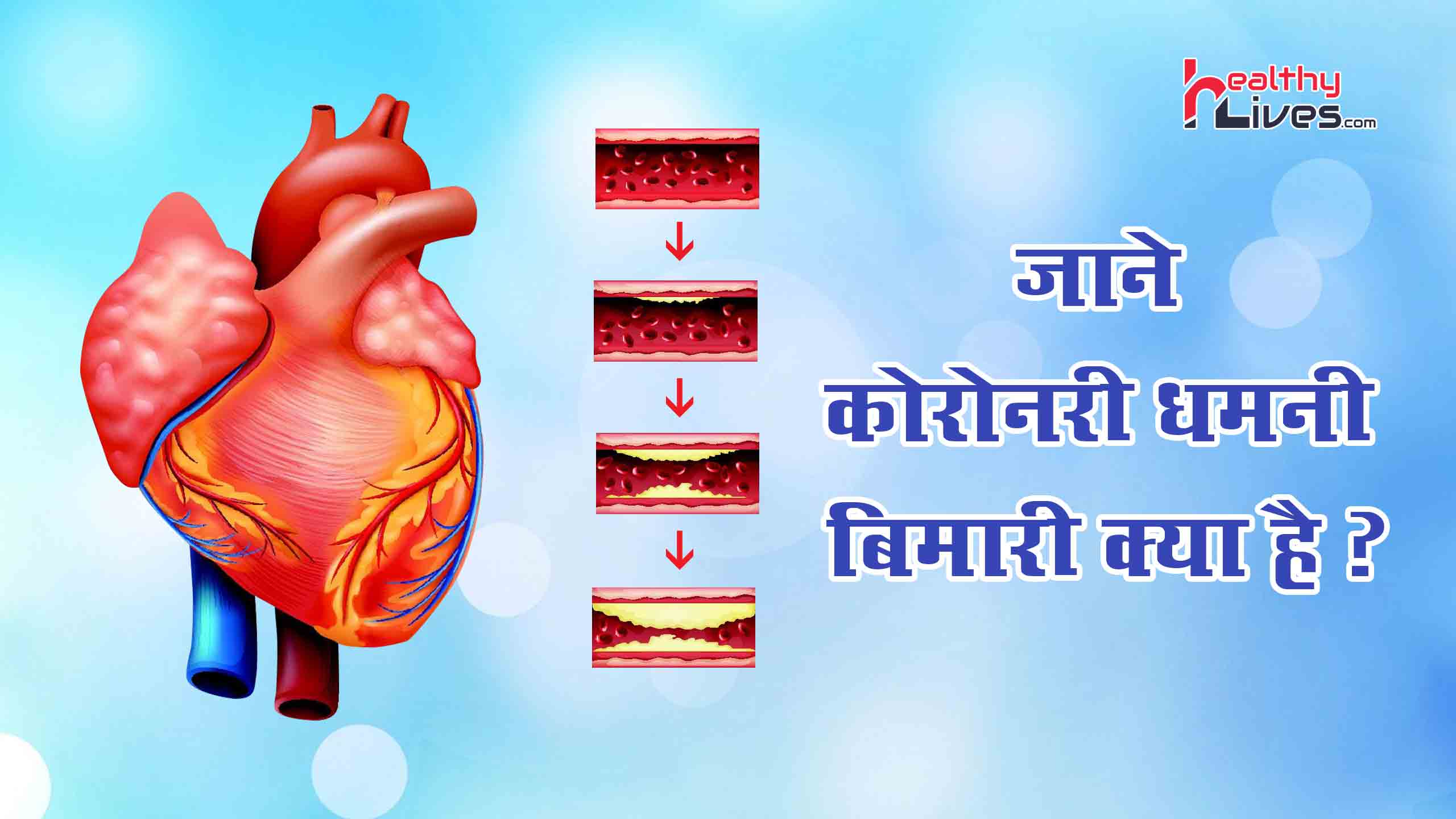 Coronary Artery Disease in Hindi: क्या है कोरोनरी आर्टरी डिजीज, जाने इसके बचाव