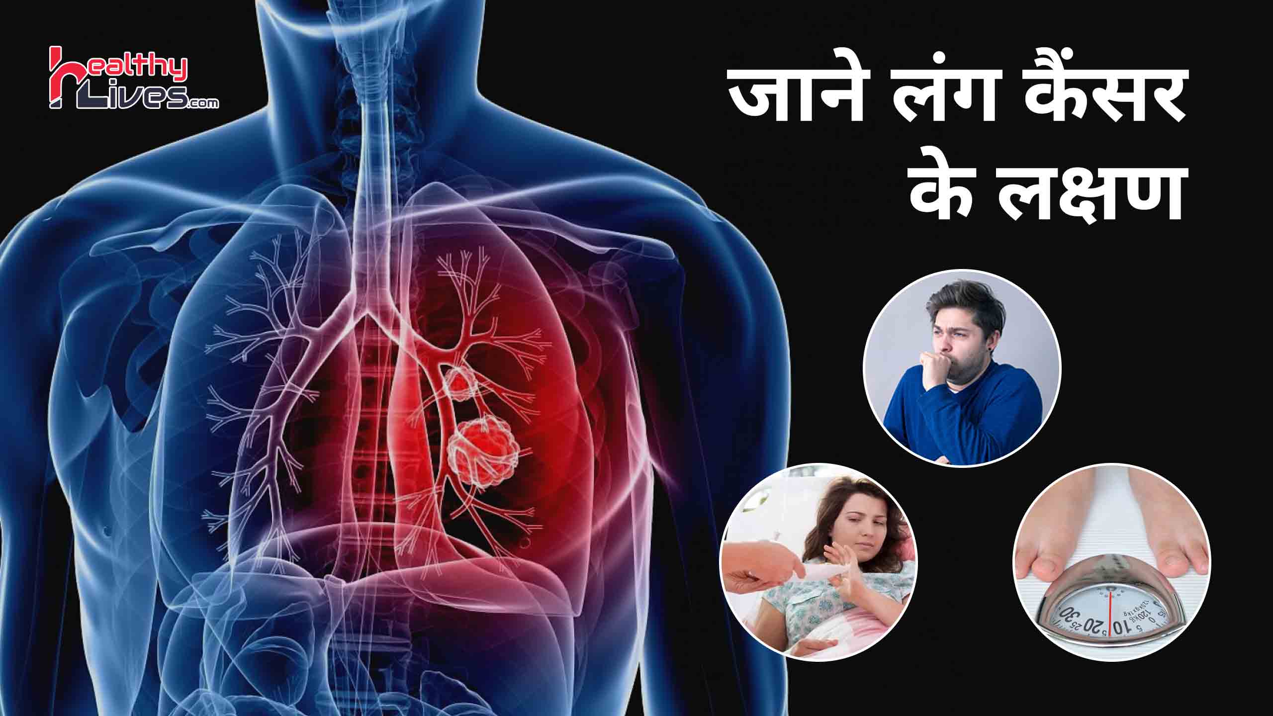 Lung Cancer Symptoms in Hindi: शुरूआती लक्षणों से पहचाने फेफड़े का कैंसर