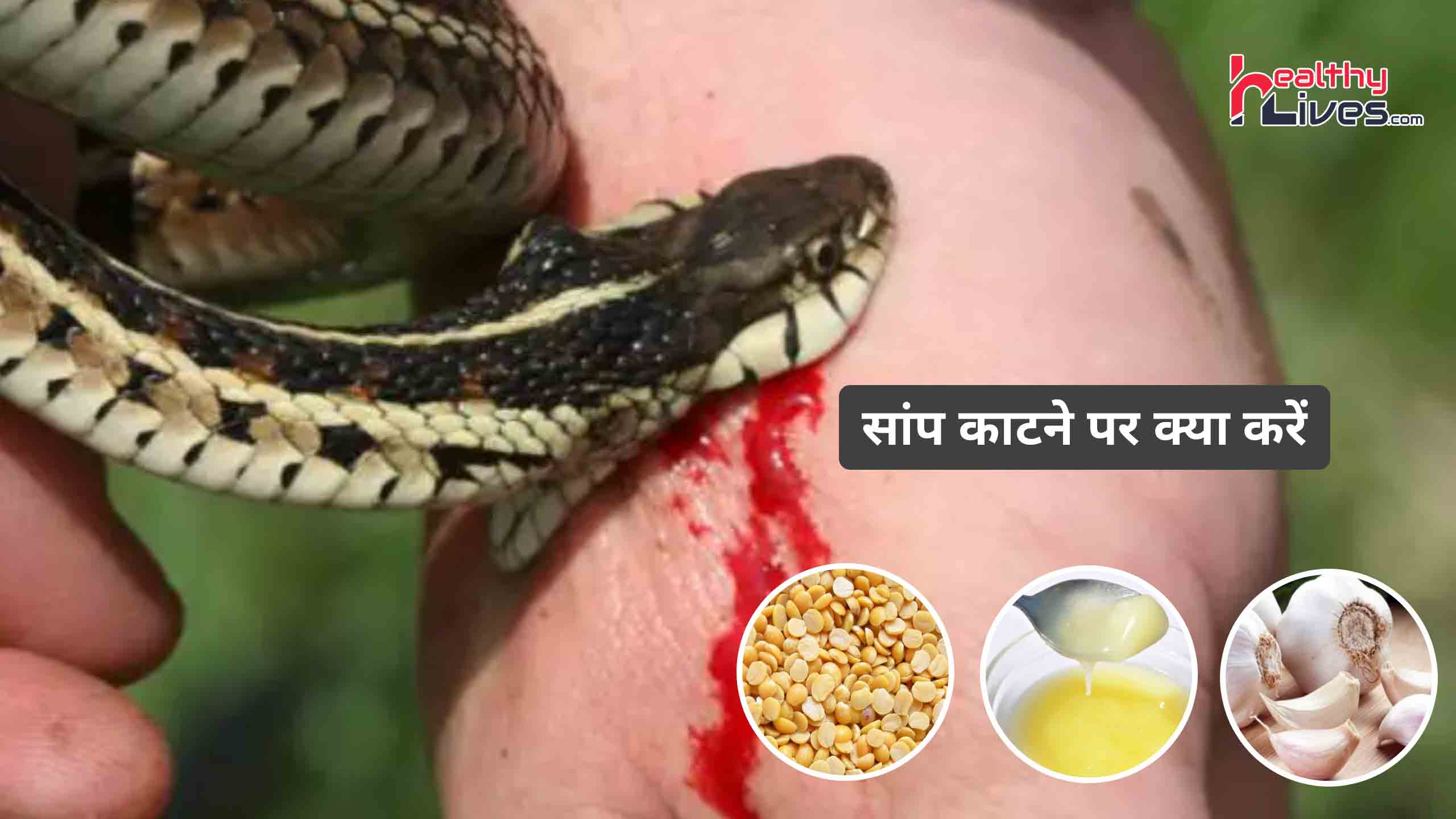 Snake Bite Treatment in Hindi: सांप काटने पर न करें पैनिक, सूझबूझ से करवाएं अपना उपचार