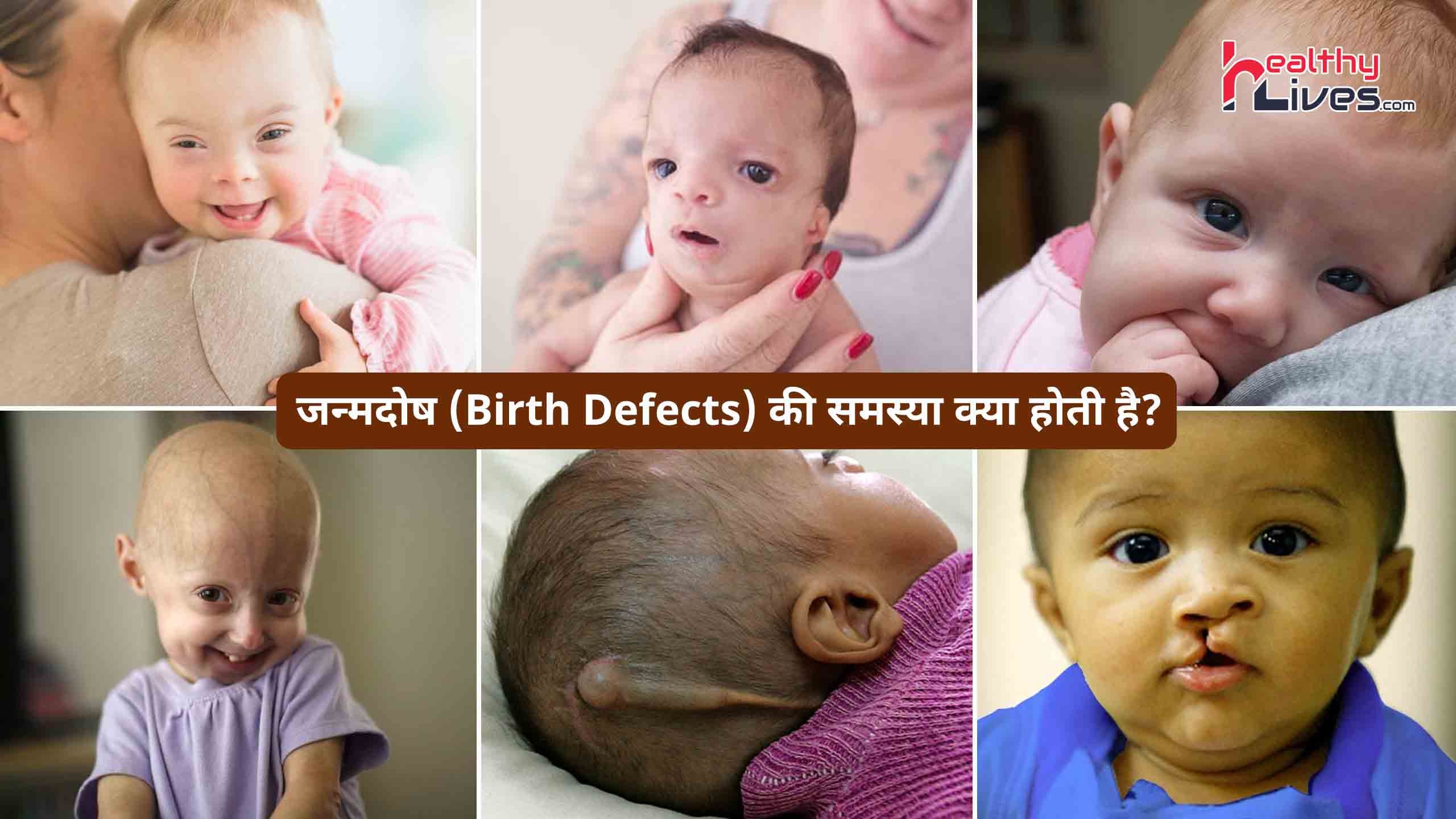 Birth Defects: जाने बच्चों में होने वाले कुछ घातक जन्मजात विकारों के बारे में