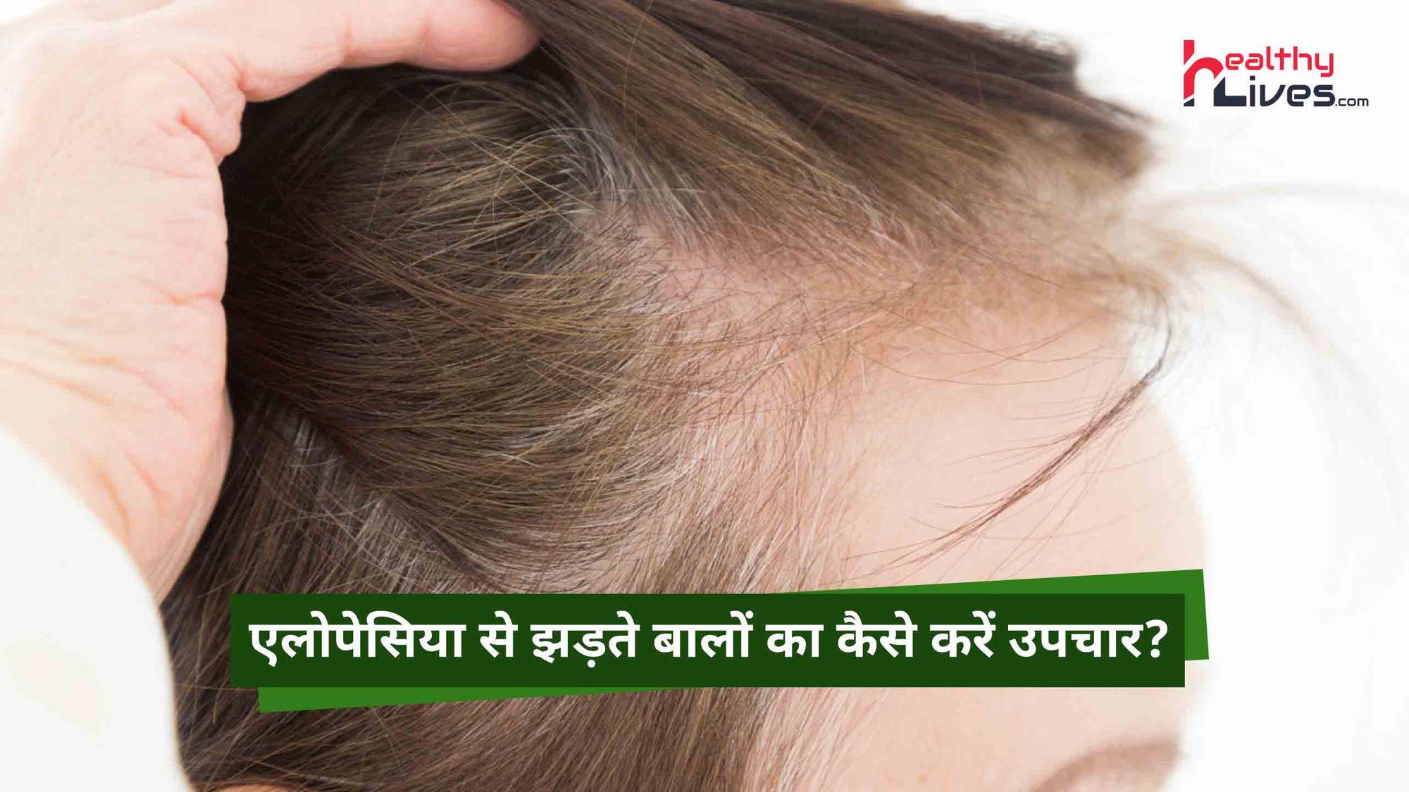 Alopecia Treatment: एलोपेसिया की समस्या से कैसे सुरक्षित रखें अपने बालों को?