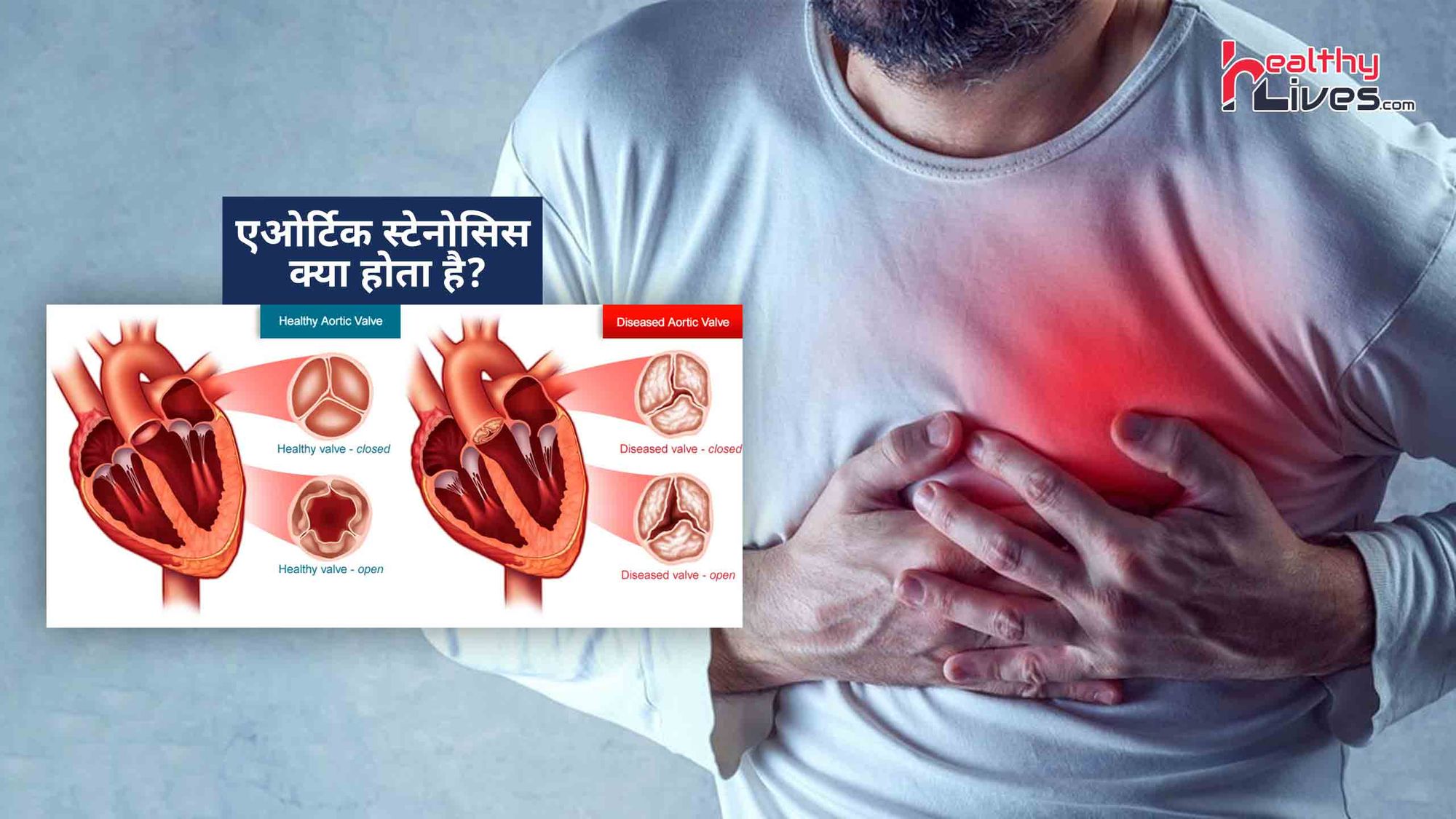 Aortic Stenosis: दिल की असामान्य आवाज एओर्टिक स्टेनोसिस का संकेत हो सकती है